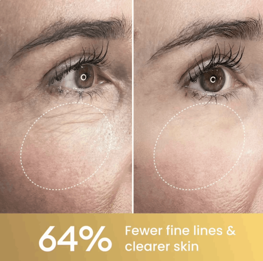 Gloramd reduce fine lines